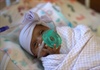 Sức sống phi thường của em bé sơ sinh nhỏ nhất thế giới